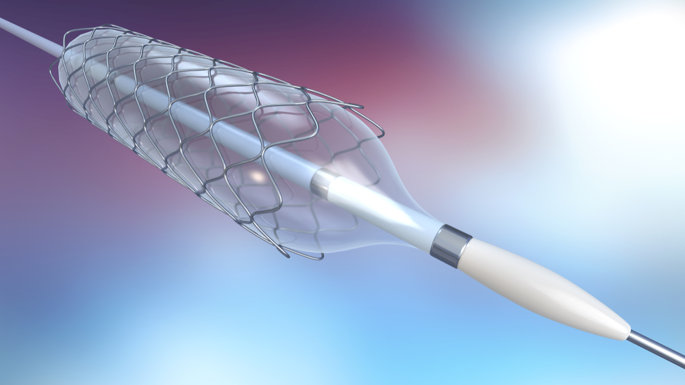 Illustration of catheter for stent implantation