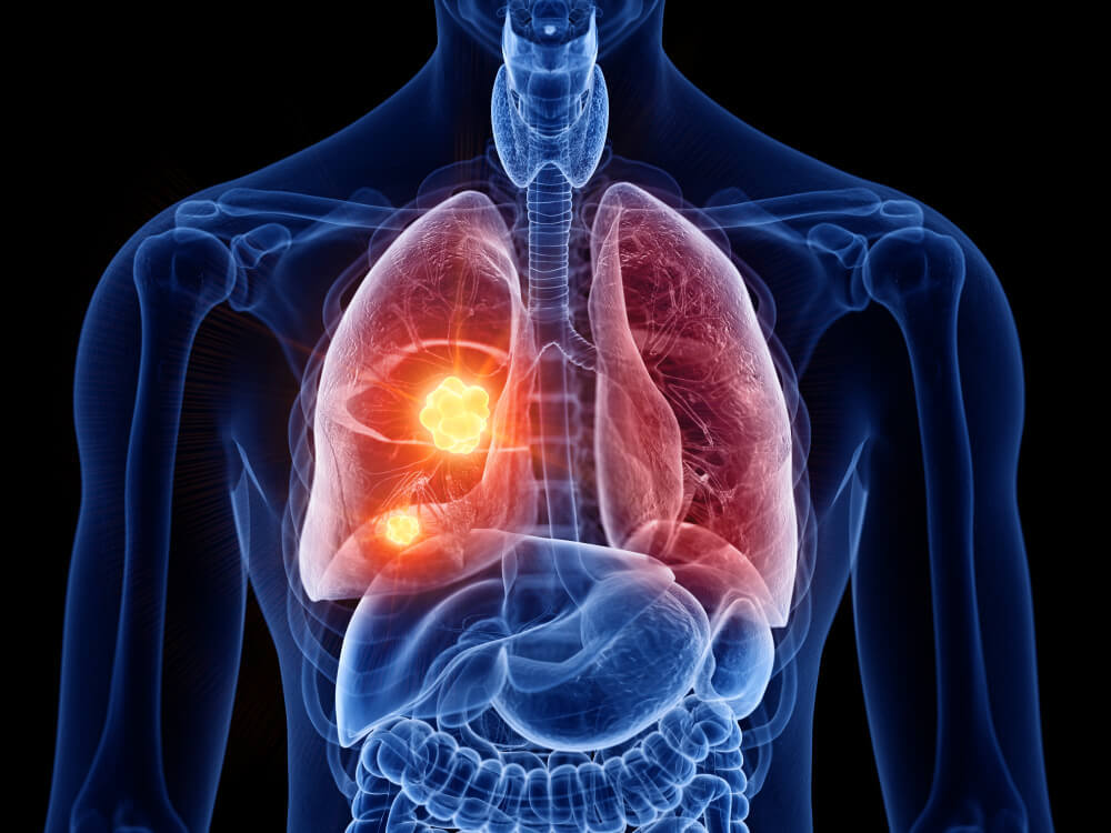 Highlighted Anatomy of Human Lungs